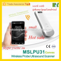 2016 New Best Price Wireless convex/linear probe Wireless linear probe ultrasound machine work with iphone/ipad/andriod MSLPU35